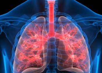 anticoagulante-popular-demonstra-potencial-para-tratar-inflamacao-pulmonar