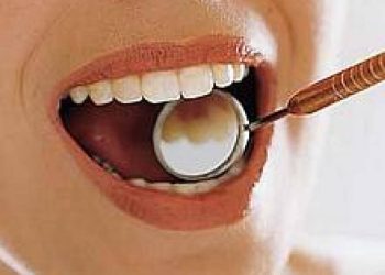 o-beneficio-do-canabidiol-para-os-dentes,-segundo-estudo