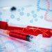 hemofilia-hereditaria:-a-importancia-do-diagnostico-e-do-aconselhamento-genetico