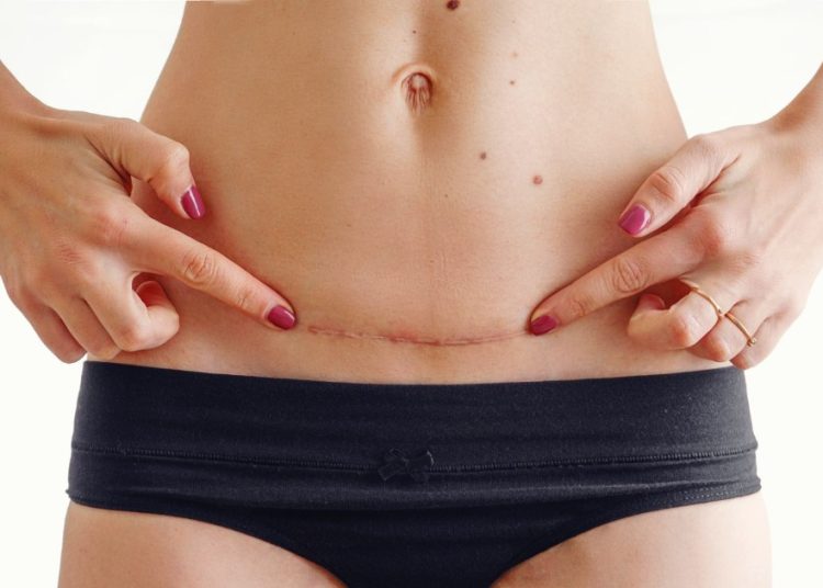 75%-das-maes-relatam-mais-confianca-apos-tratamentos-esteticos,-aponta-pesquisa
