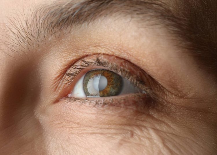 campanha-maio-verde-chama-atencao-para-o-risco-invisivel-do-glaucoma