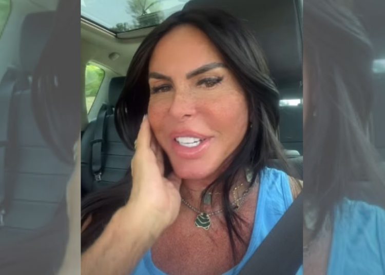 gretchen-rebate-uso-de-filtro-e-comemora-resultado-de-harmonizacao-facial:-‘rosto-mais-fino’-–-jovem-pan