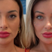 andressa-urach-relata-dor-apos-cirurgia-para-mudar-cor-dos-olhos:-‘estou-arrependida-de-ter-feito’-–-jovem-pan