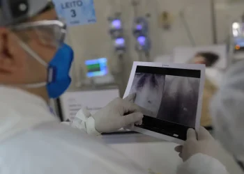 Covid é principal causa de internação por síndrome respiratória no Rio