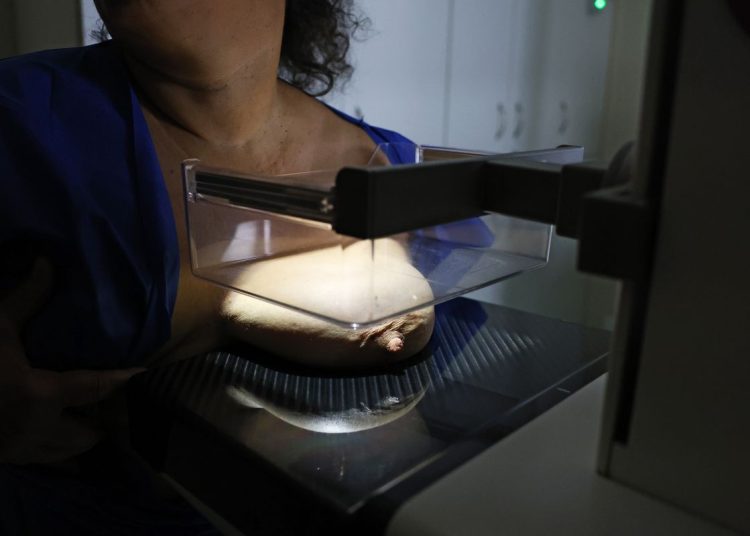 Vigitel: 92% das brasileiras entre 50 e 69 anos fizeram mamografia
