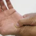 Novas diretrizes ampliam o tratamento de fibromialgia pelo SUS
