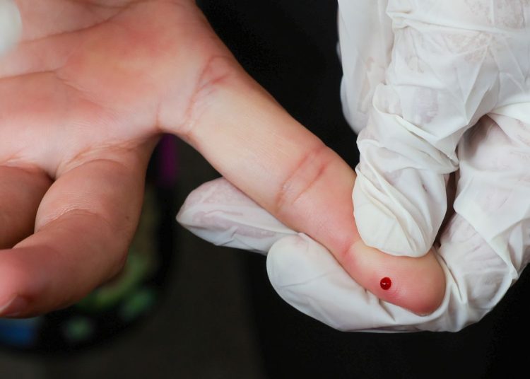 Teste rápido de dengue passa a integrar tabela do SUS