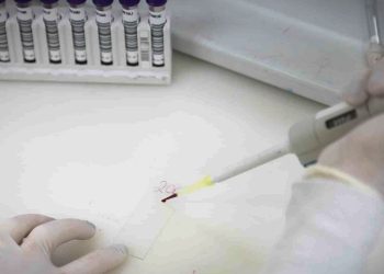 Paciente em SP com suspeita de ebola testa positivo para meningite