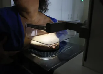 ANS defende que plano cubra mamografia digital sem restrição de idade