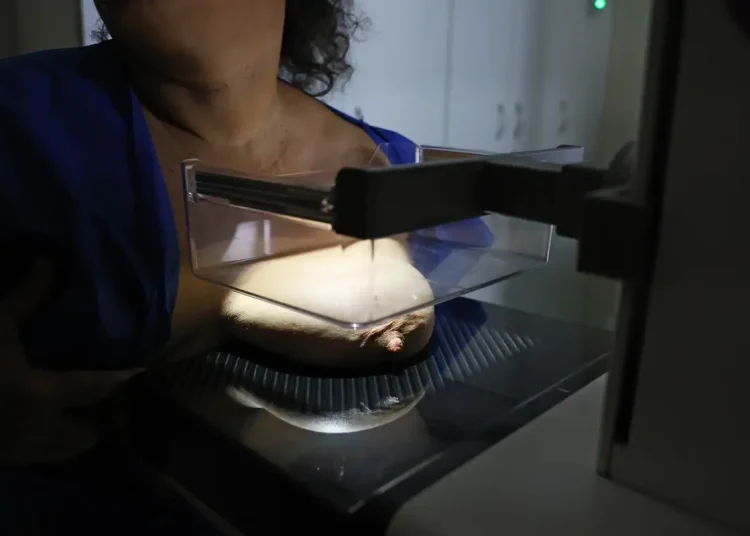 ANS defende que plano cubra mamografia digital sem restrição de idade