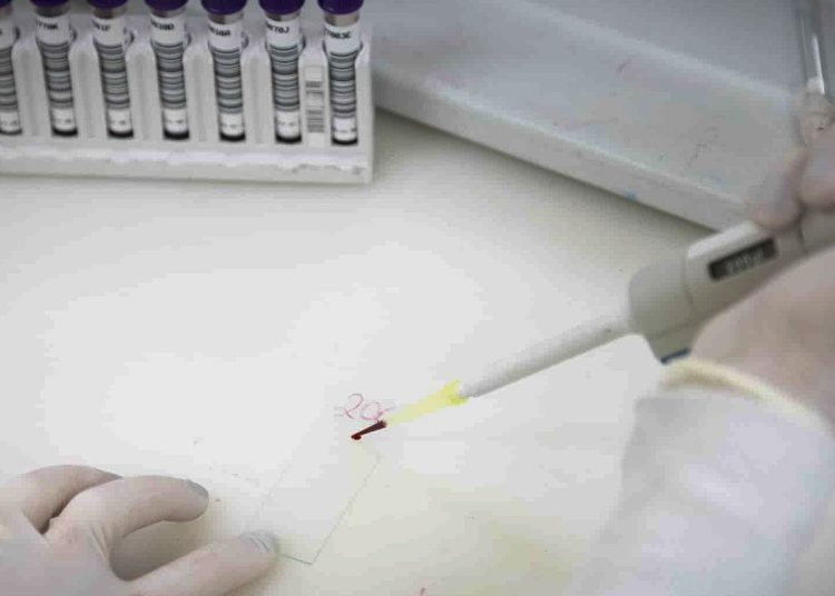 Exames descartam ebola em imigrante da República Democrática do Congo
