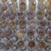 Uso de medicamento oferecido no SUS reduz casos de malária no Brasil