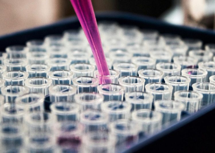 Diagnóstico precoce da AME é divisor de águas, afirma paciente