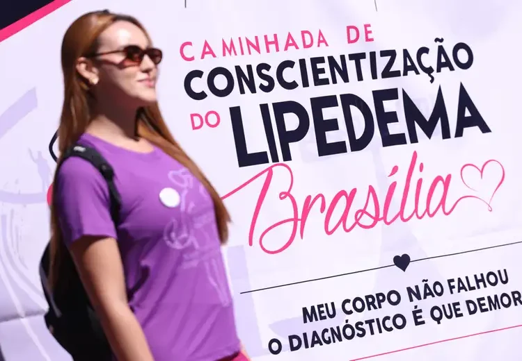 Caminhadas buscam conscientizar população sobre lipedema