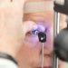 Retinopatia: doença ocular afeta um em cada três diabéticos